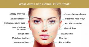 dermal-filler-Sydney-CBD-Beauty-Cosmetic