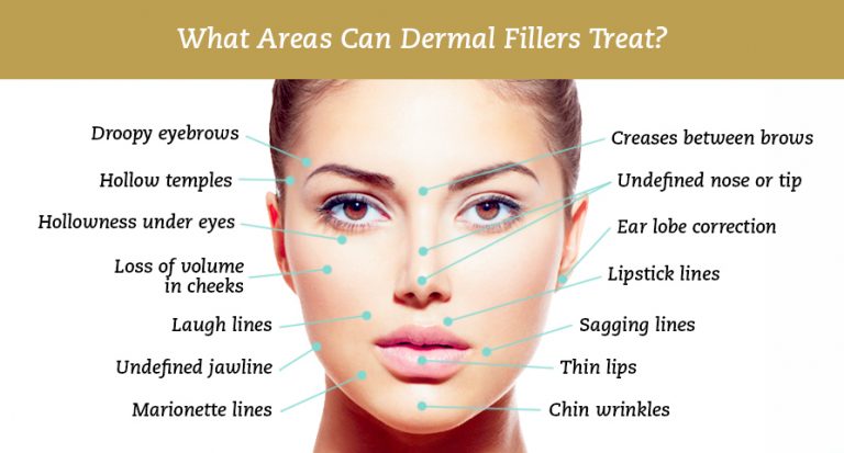 Dermal Fillers The Beauty Clinic 70 Pitt St Sydney dermal-fillers-the-beauty-clinic-70-pitt-st-sydney
