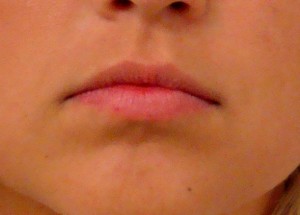 Lips before