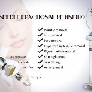 rf-micro-needling