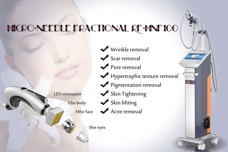 rf-micro-needling