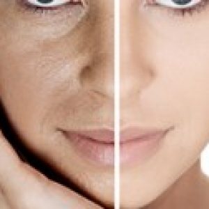 Sydney-Beauty-Chemical-Peels