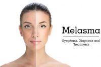 Beauty-Sydney-Melasma-Dr-Bitlan