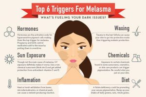 Beauty-Sydney-Melasma-Dr-Bitlan-hormones