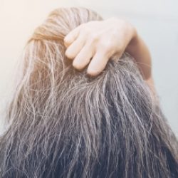 The-beauty-and-cosmetic-clinic-sydney-cbd-Hair-loss-treatment