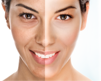 The-beauty-and-cosmetic-clinic-sydney-cbd-Super-facial