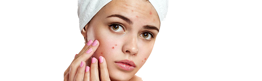 Acne-concerns-Beauty-and-cosmetic-sydney-cbd