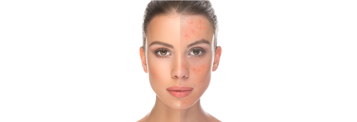 Pigmentation-and-melasma-rejuvenation-The-Beauty-and-Cosmetic-Clinic-Sydney-CBD