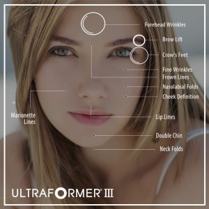 Ultraformer_HIFU_The_Beauty_Clinic_Sydney_CBD