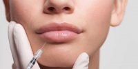 Lip_Filler_The_Beauty_and_cosmetic_Clinic_Sydney_cbd