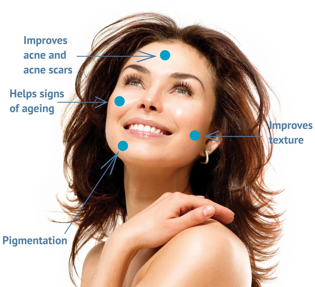 Chemical Peels - The Beauty and Cosmetic Clinic @ 70 Pitt St