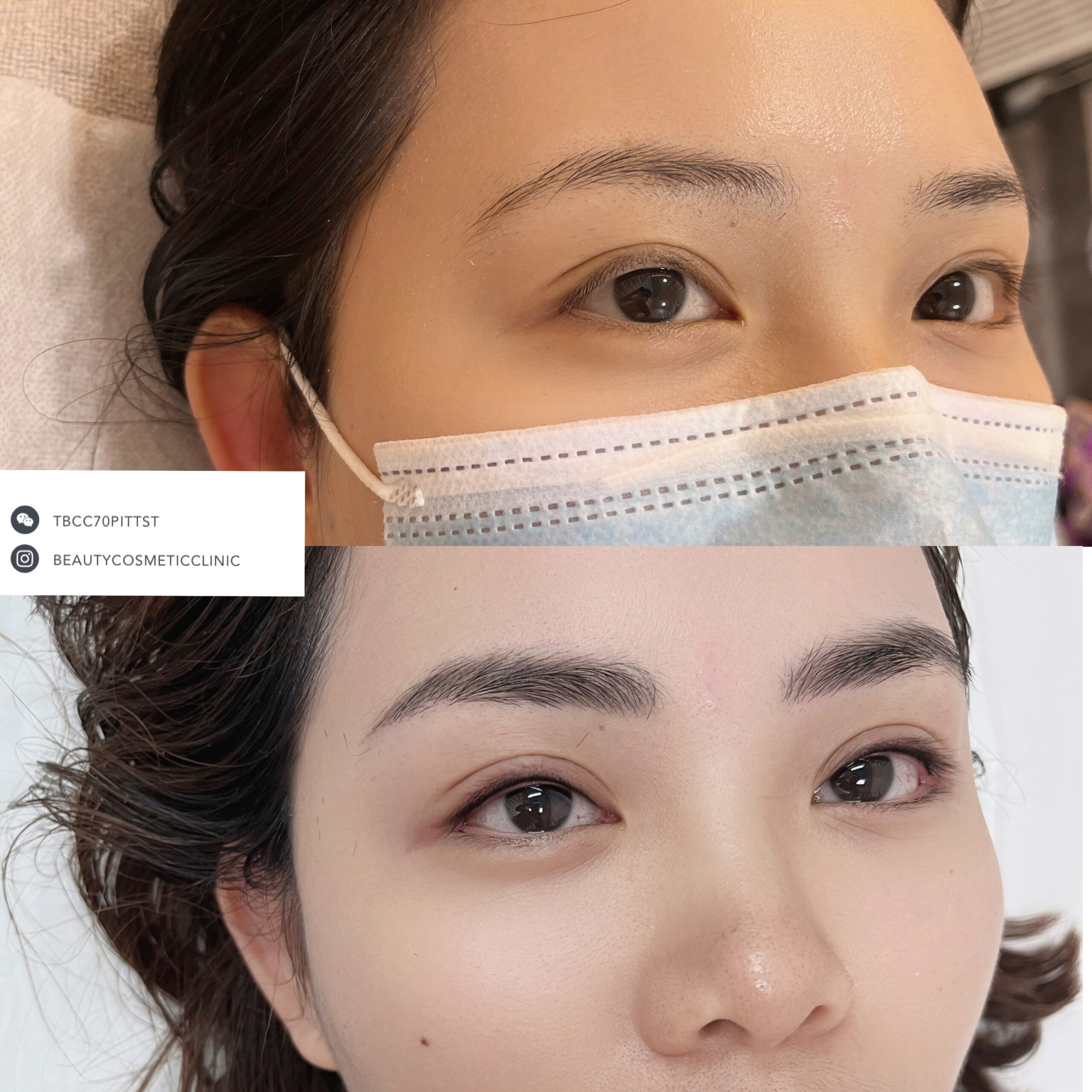 The Beauty and Cosmetic Clinic Cosmetic tattoo