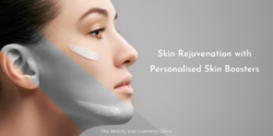 Skin rejuvenation with skin boosters