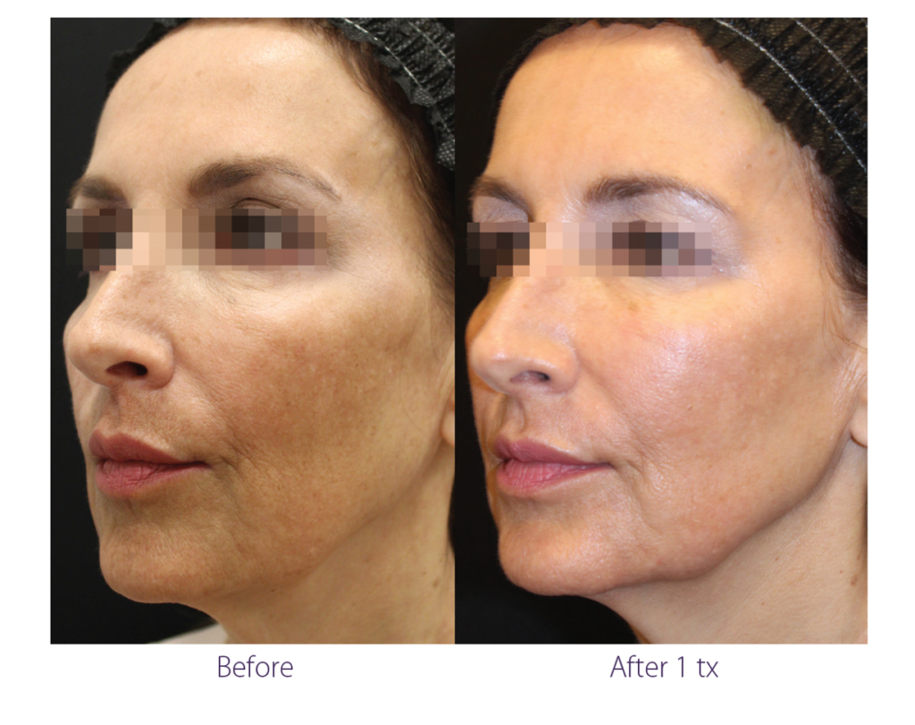 The Beauty and Cosmetic clinic results 1