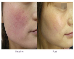 The Beauty and Cosmetic clinic results 2