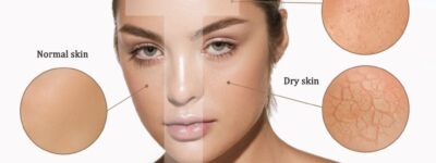 Using-Dry-Skin-Products-The-beauty-Clinic