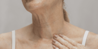 Loose-neck-skin-Thebeautyclinic