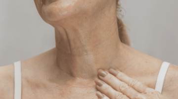 Loose-neck-skin-Thebeautyclinic