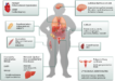 insulin resistance