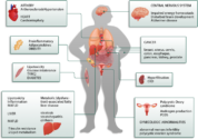 insulin resistance