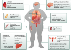 insulin resistance