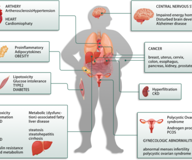 insulin resistance